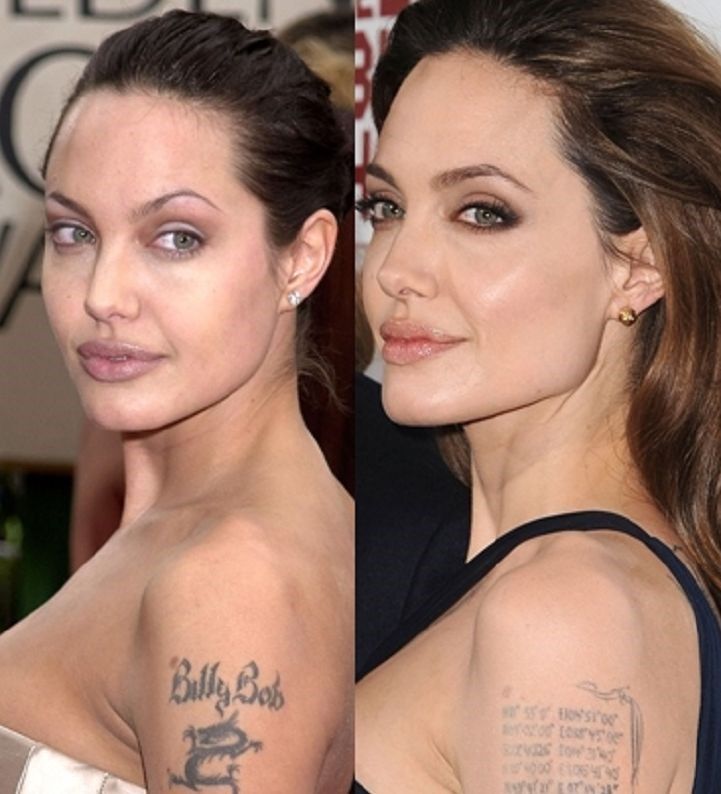 http://www.celebplasticsurgeryonline.com/wp-content/uploads/2015/08/Angelina-Jolie-before-and-after-plastic-surgery-and-removing-tatoo.jpg