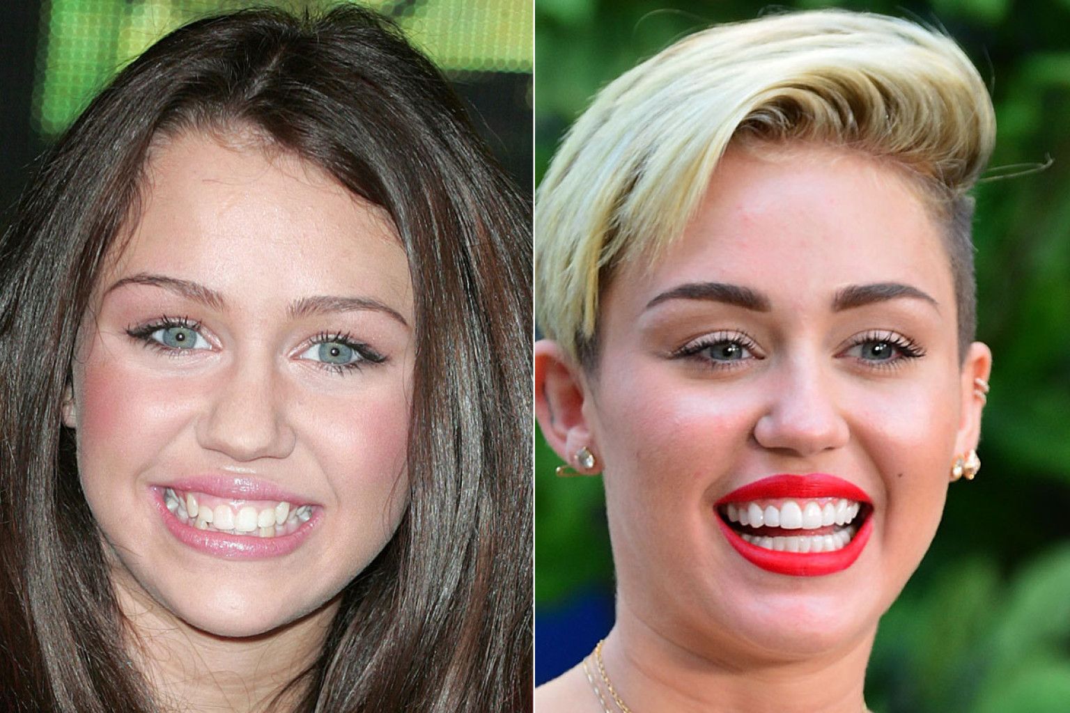 20-hollywood-celebs-you-didn-t-know-have-fake-teeth