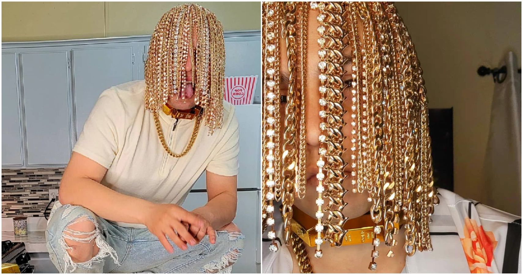 Gold Rush Rapper Dan Sur Replaces Hair With Surgically Implanted Gold